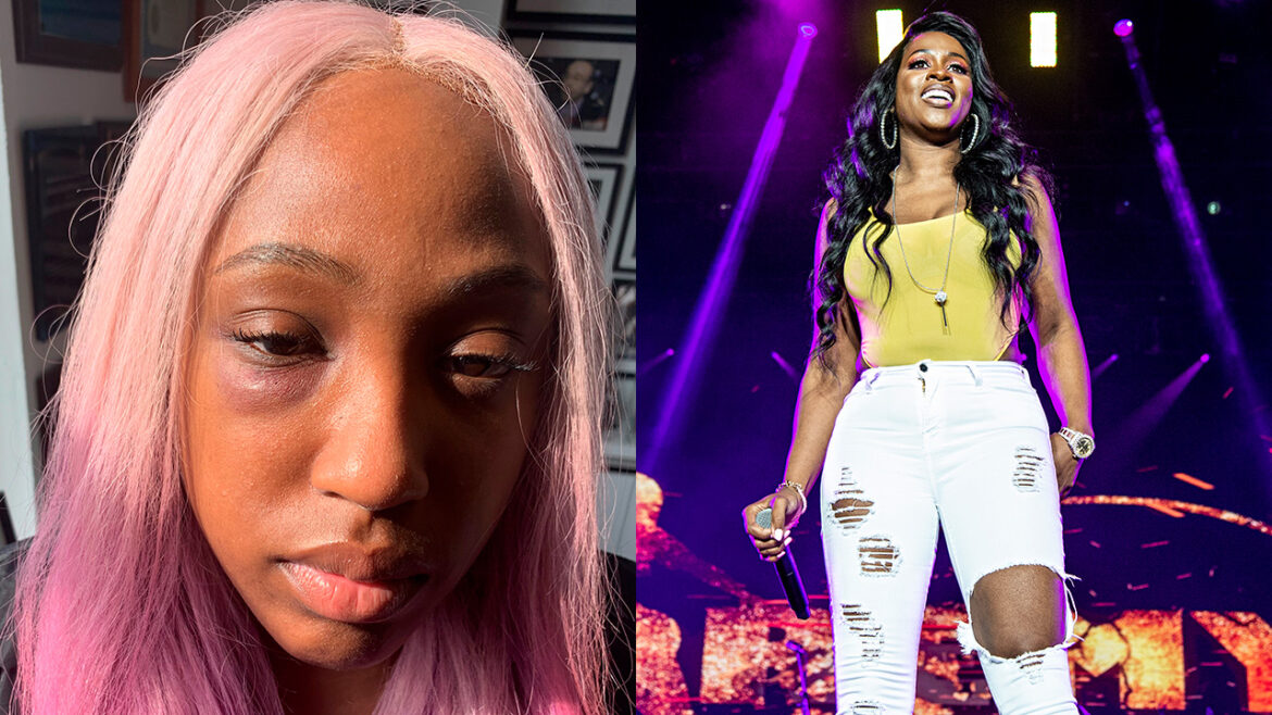 Remy Ma Turns Herself In, Facing Assault Charges in Brittney Taylor Attack
